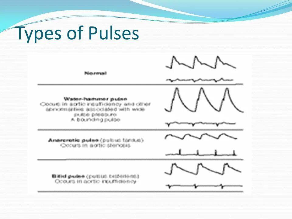 Pulse current