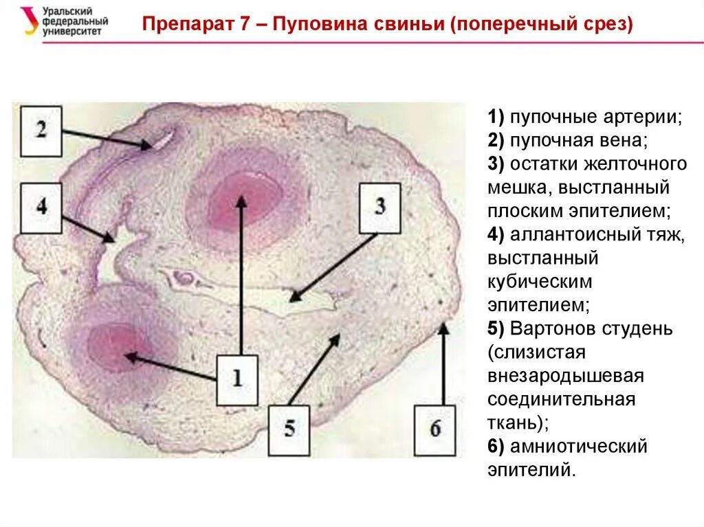 Желточный мешок гистология. Пуповина человека гистология препарат описание. пуповина человека препарат гистология. строение пупочного канатика гистология. гистологическое строение пуповины.