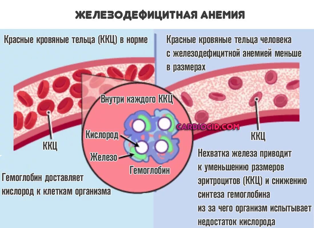 Анемия кислород