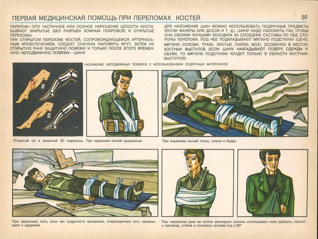 Оказание первой помощи на войне. Оказание первой помощи плакат СССР. Плакат первая медицинская помощь. Плакаты по первый попощ. Военно медицинские плакаты.