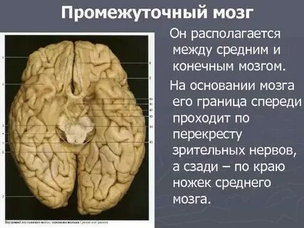 Границы мозга