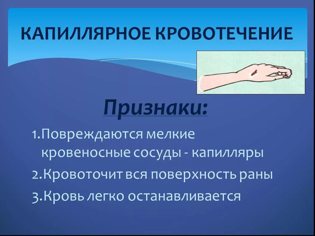 Кровотечение какие симптомы. Симптомы капиллярного кровотечения. Признаки капиллярного кровотечения. Капиляноекровотечение. Признаки капилярногокровотечения.