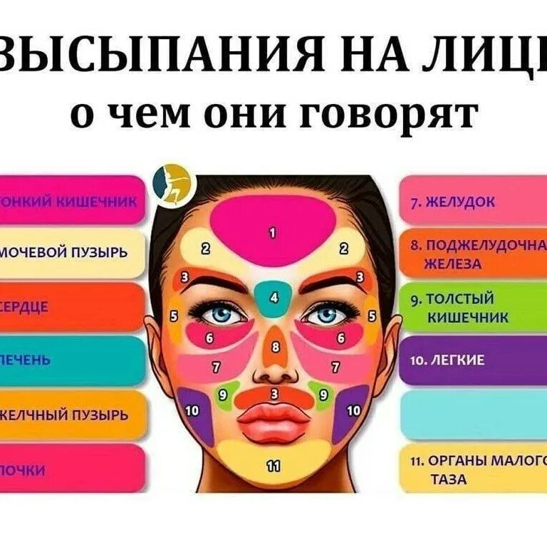 Прыщи на лице причины. Высыпания на лице причины по зонам. Прыщи на лице причины по зонам у женщин. Причина прыщей на лице у женщин. Карта прыщей на лице.