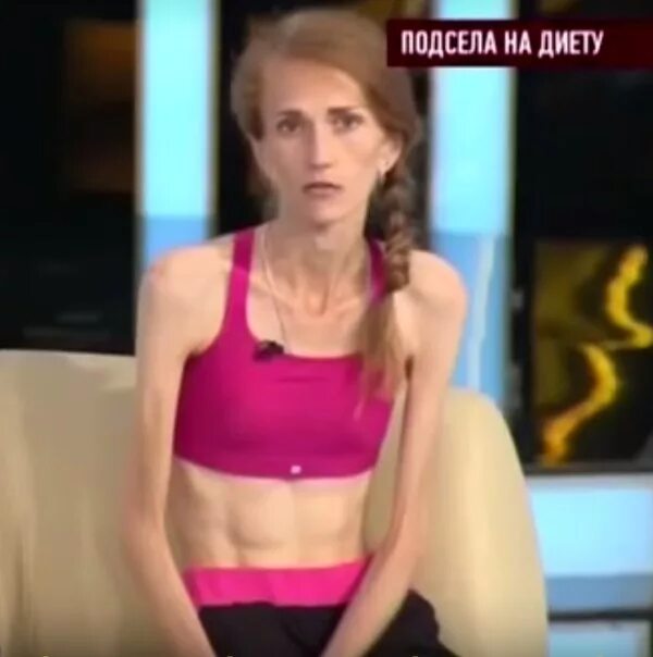 Катя девушка с анорексией из битвы экстрасенсов
