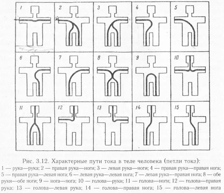 Какие петли тока наиболее опасны. Путь тока через тело человека. Петля тока через тело человека. Пути протекания тока через человека. Пути прохождения тока через тело человека.