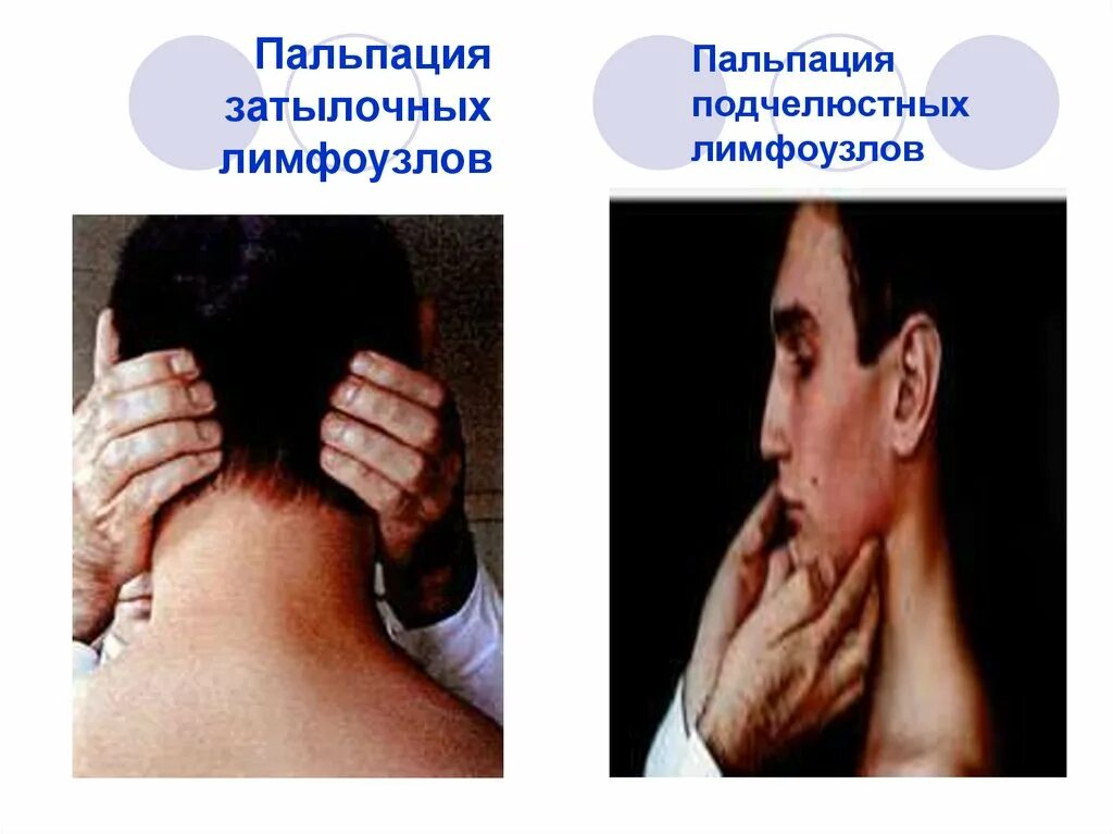 Обследование лимфоузлов. Пальпация челюстных лимфоузлов. пальпация затылочных лимфоузлов. пальпация затылочных лимфатических узлов.
