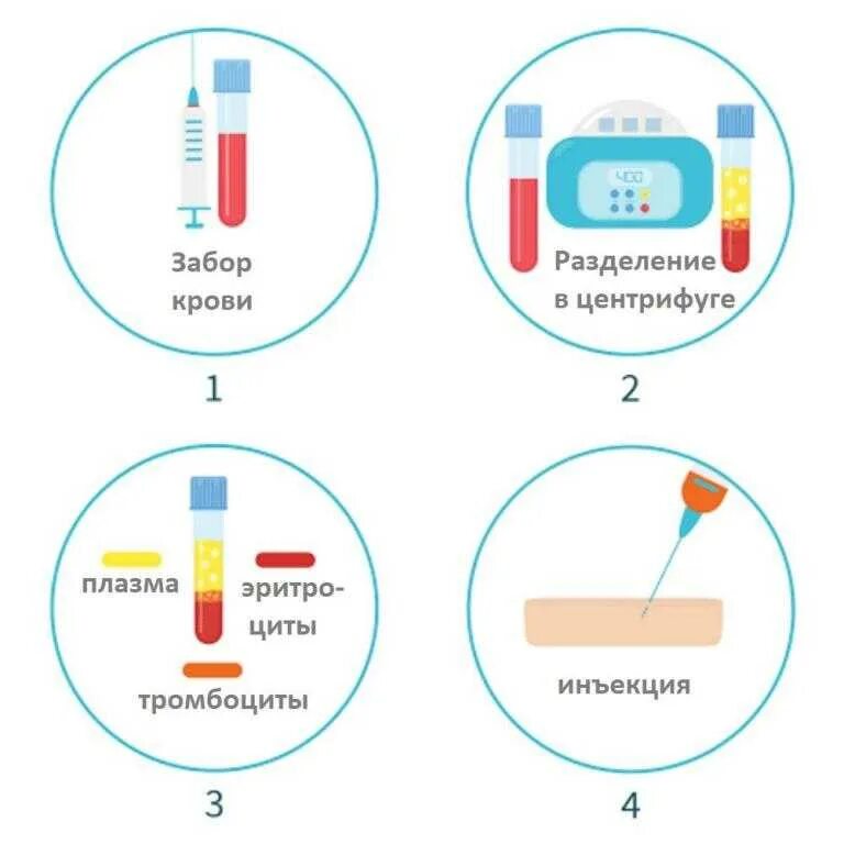 Плазмолифтинг PRP терапия. PRP терапия Platelet Rich Plasma. PRP терапия Cortexil.