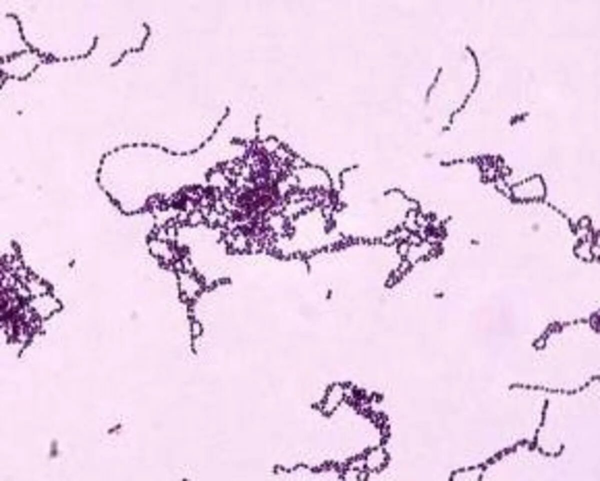 Стрептококк микроскопия. Streptococcus pyogenes мазок. Стрептококк 6. Стрептококки генцианвиолет.