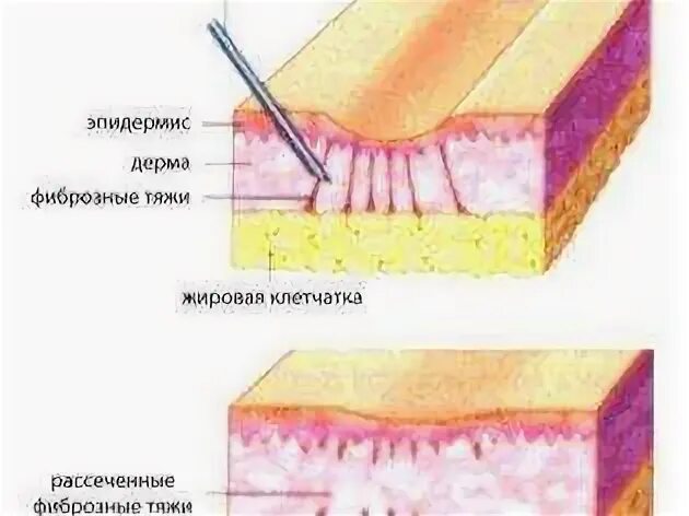 Как долго заживает разрез