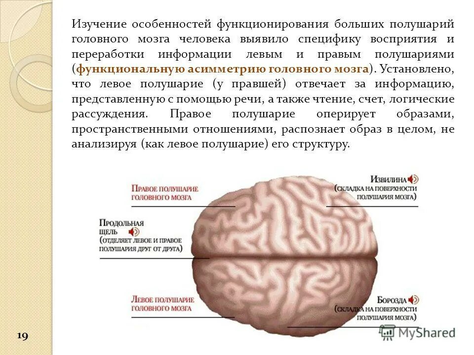 Левая гемисфера головного мозга