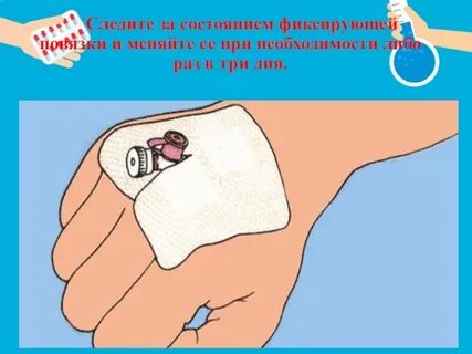 Состояние повязки