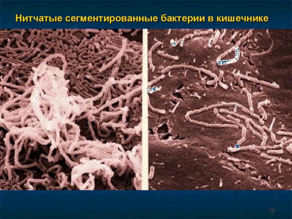 Рубцовые бактерии. Колонизация микроорганизмов. Биопленки микроорганизмов. Микробы в кишечнике.