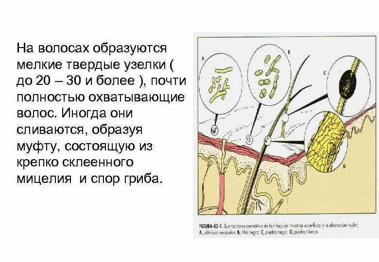 Почему образуются узлы. Почему на волосах появляются узелки. Почему появляются узлы на волосах. Узелок на волоске. Как образовывается узел в омегаверсе.