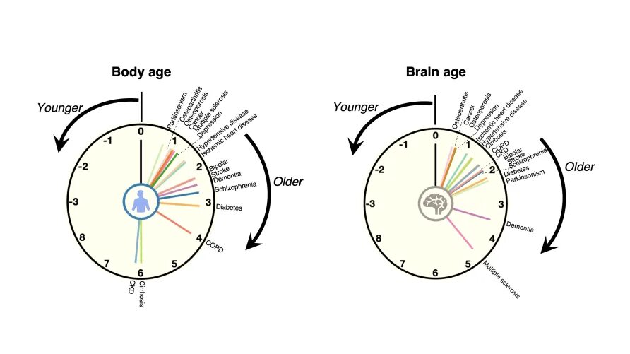 Brain age. Chronological age.