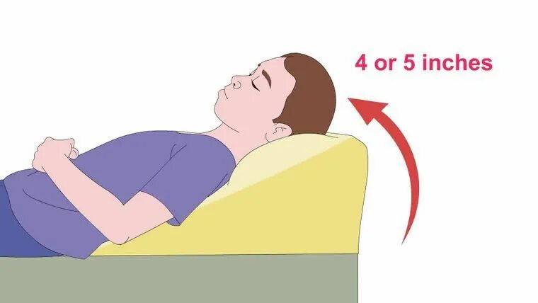 При рефлюксе на каком боку. Кровать при рефлюксе. Сон при рефлюксе. На каком боку спать при рефлюксе. Сон с приподнятым изголовьем.