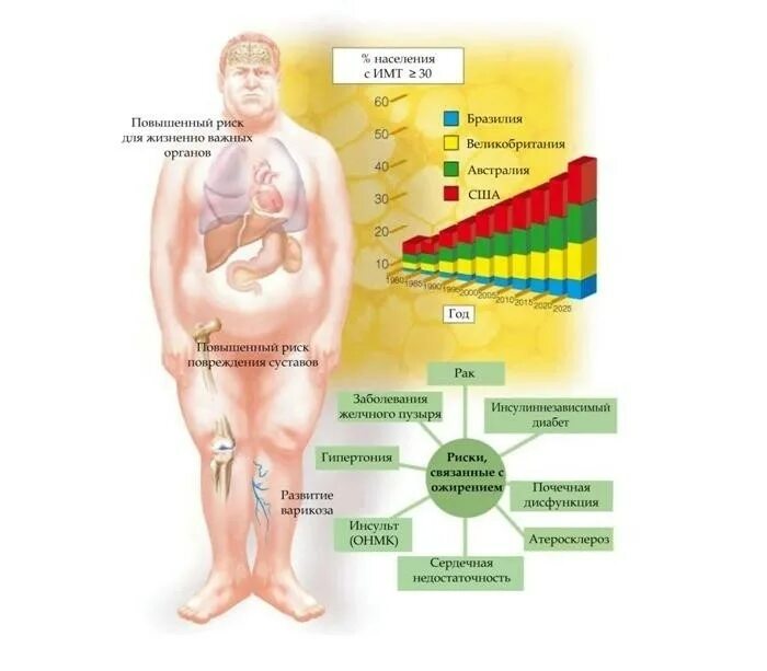 Нарушения функций органов и систем при ожирении.. Ожирение схема. Предпосылки ожирения.