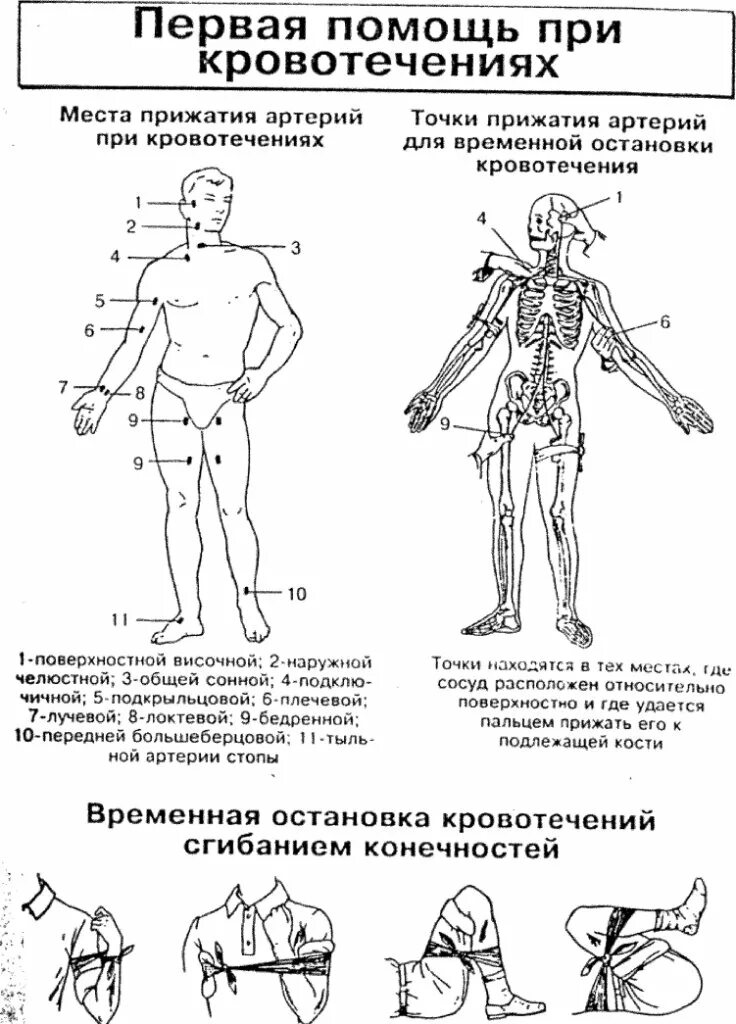 Быстрая помощь при кровотечении. Схема оказания первой помощи при кровотечениях. места прижатия артерий при кровотечении таблица. таблица пальцевого прижатия артерий. точка прижатия височной артерии располагается.