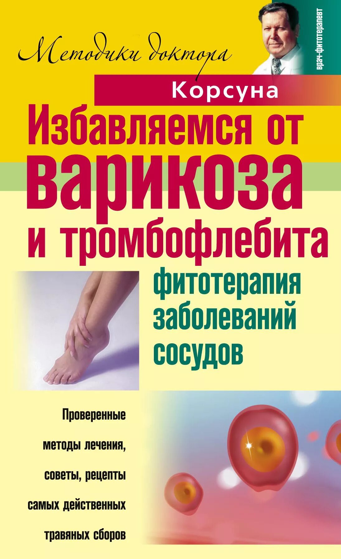 Болезни сосудов лечение. Избавление от варикоза. Сосудистые заболевания книга.