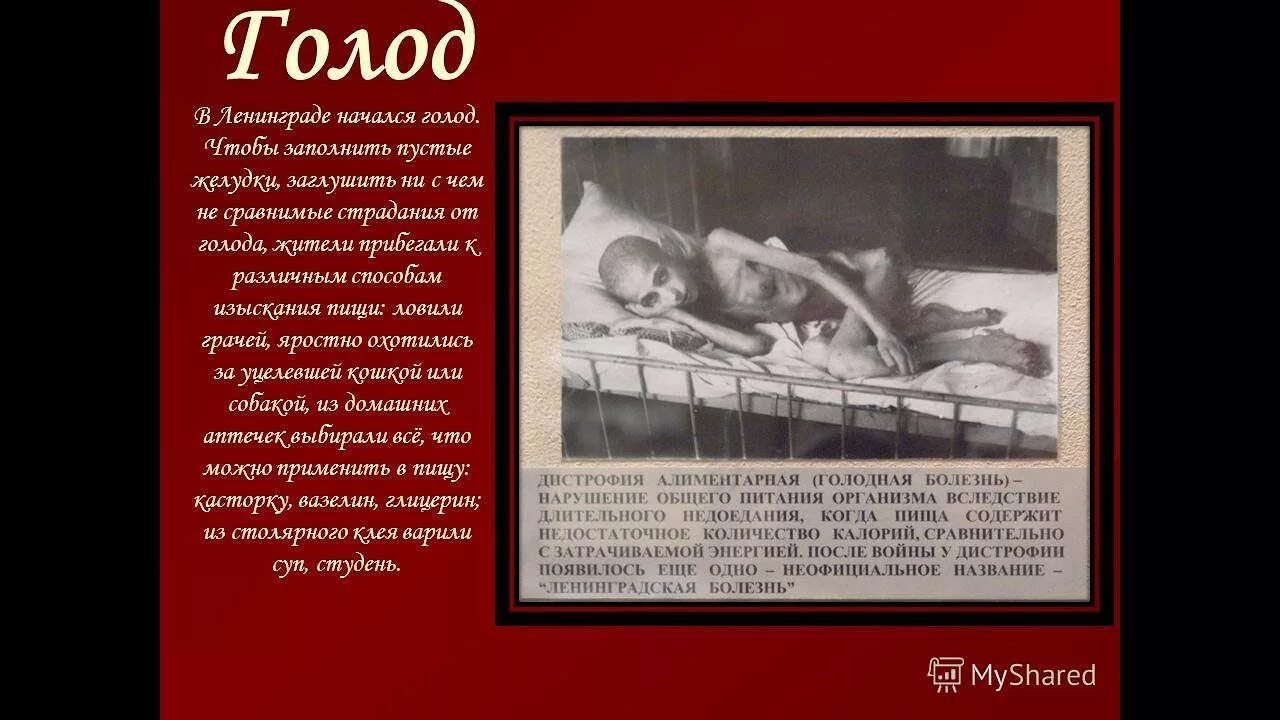 Ленинград блокада Голодные смерти. Дистрофия блокада Ленинграда голод. Алиментарная дистрофия блокада Ленинграда. Блокадный Ленинград голод дети.