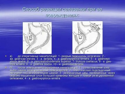 Повреждение органа 6