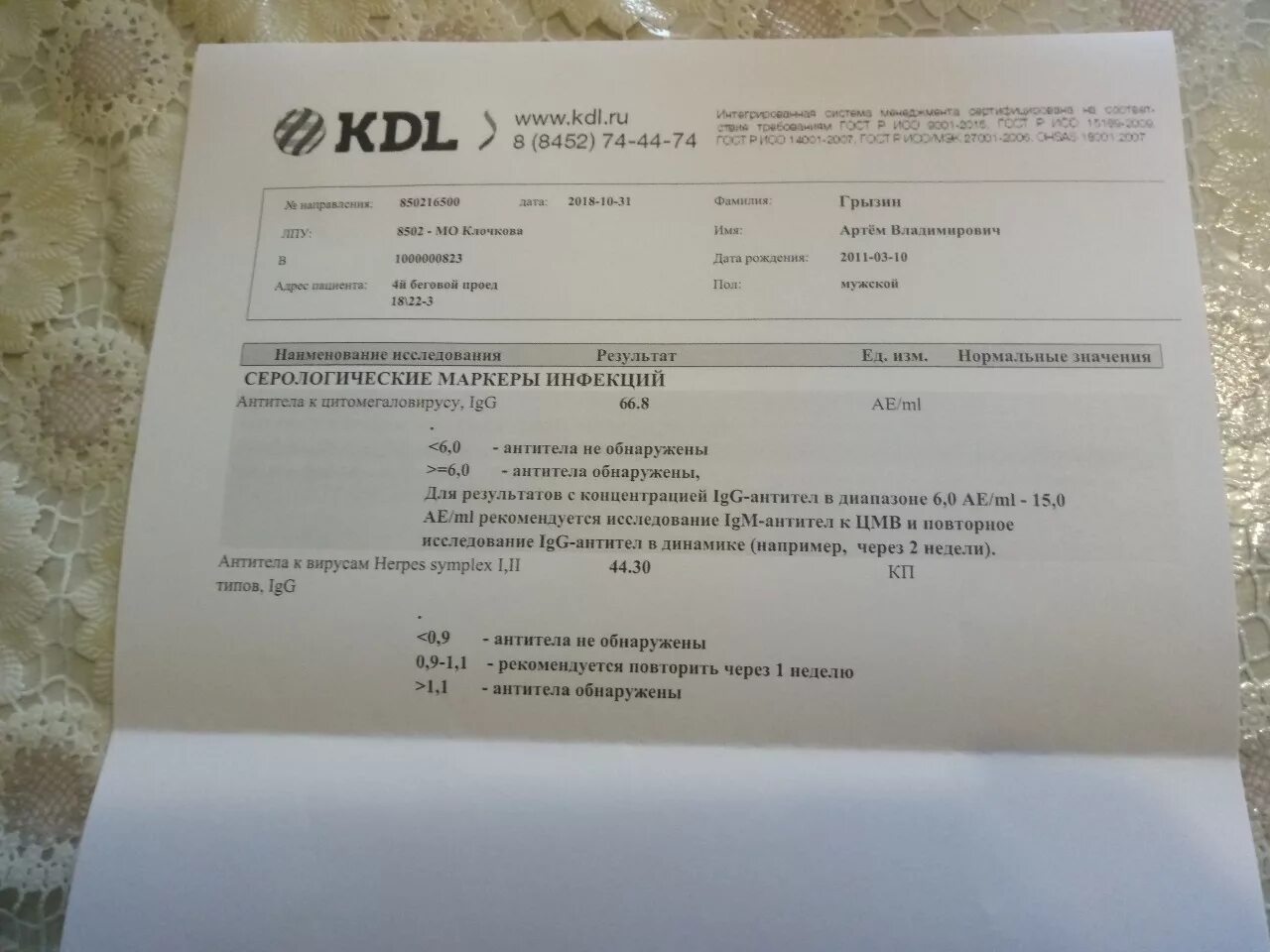 антитела к коронавирусу igm 1. анализ на коронавирус коэффициент антитела. Sars-cov-2, антитела igm. антитела к коронавирусу sars-cov-2 (covid-19). 4.