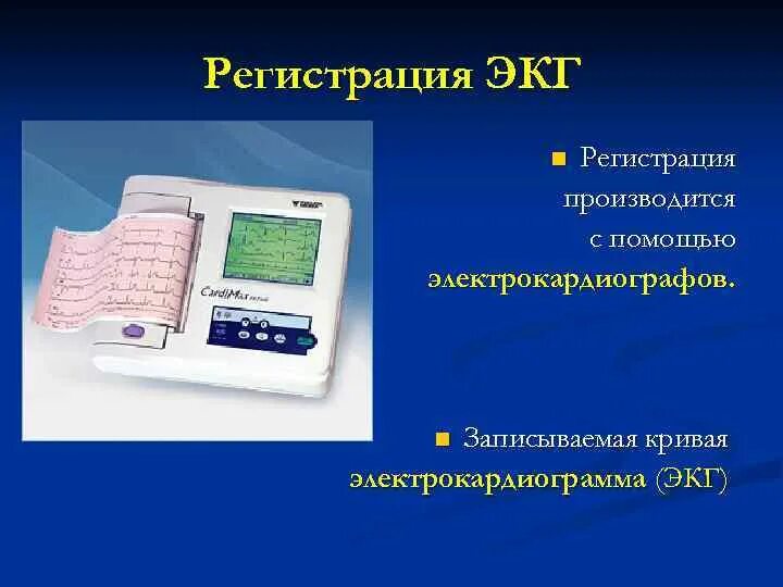 Методика регистрации и основные элементы экг. Техника регистрации электрокардиограммы. Методика регистрации экг. Усиленные однополюсные отведения экг. Стандартные отведения при экг.