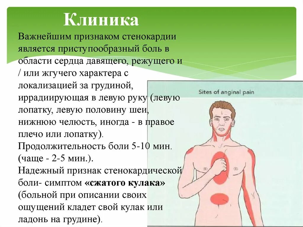 Иррадиация боли в левую руку. Боли в области сердца. Боль в области сердца за грудиной. Боли в области сердца симптомы. Боль за грудиной симптомы.