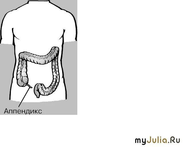 С какой стороны живота находится аппендицит