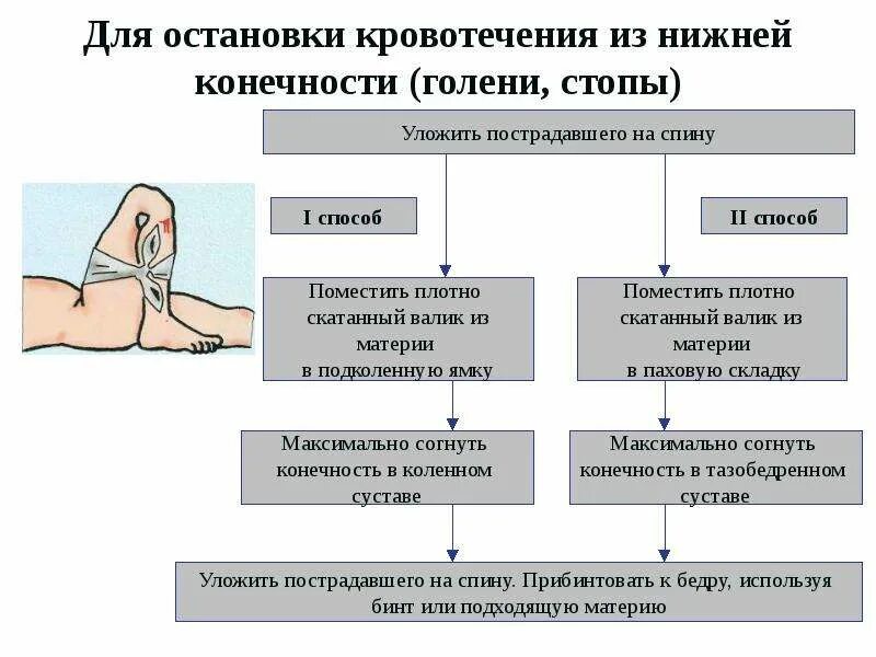 Для остановки кровотечения из нижней конечности (голени, стопы). Остановка кровотечения на нижней конечности. При кровотечении из голени:. Способы временной остановки наружного кровотечения. Как остановить кровотечение конечностей