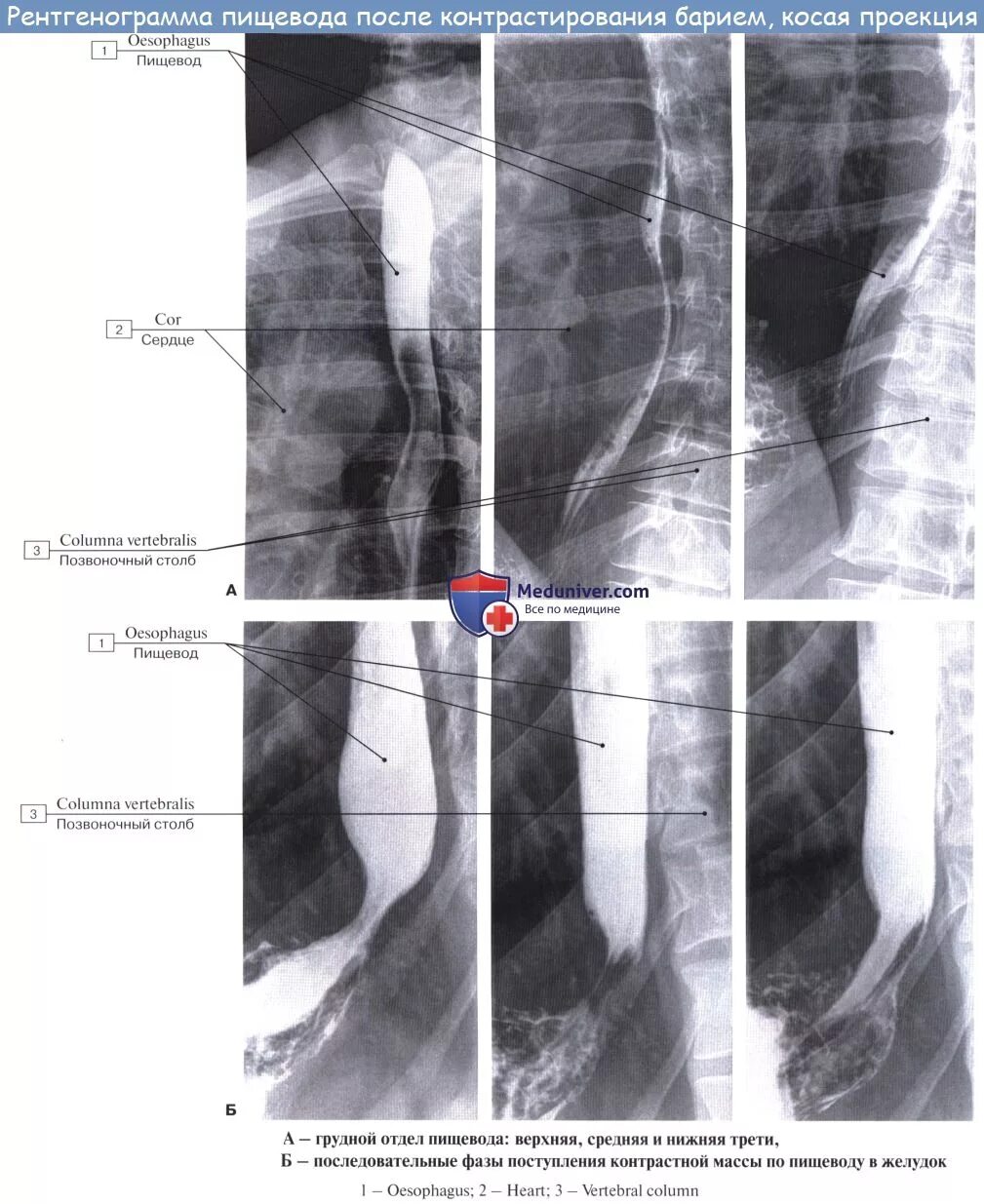 Сосуды пищевода. Рентгеноанатомия контрастированного пищевода. Рентгенография желудка Тренделенбурга. Отделы пищевода на рентгенограмме. Анатомия пищевода рентген.