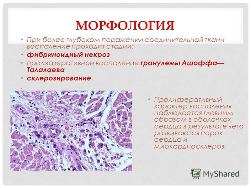 волокнистый хрящ клетки. поперечно скелетная мышечная ткань. морфология ткани. ассоциированная лимфоидная ткань. морфология ткани.