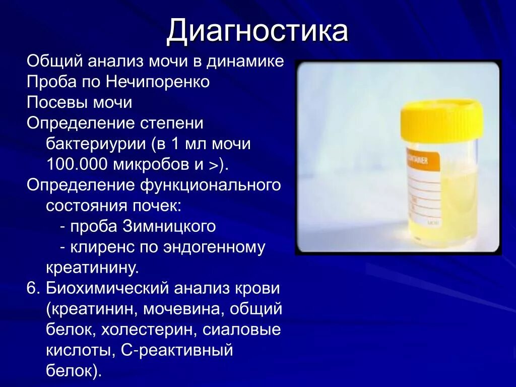 Исследование, по Зимницкому, по Нечипоренко.. Исследование мочи по Нечипоренко и Зимницкому. Моча исследование. Выполнение общего анализа мочи.