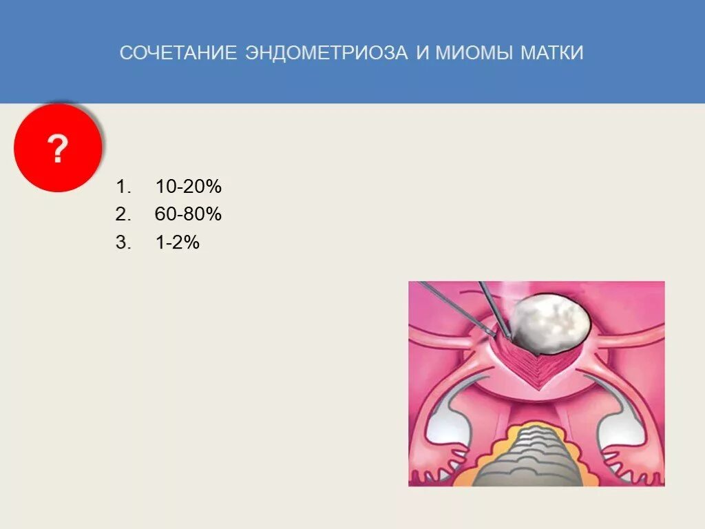 Анализы при эндометриозе. Тазовая боль при эндометриозе. Тазовая боль слайды.