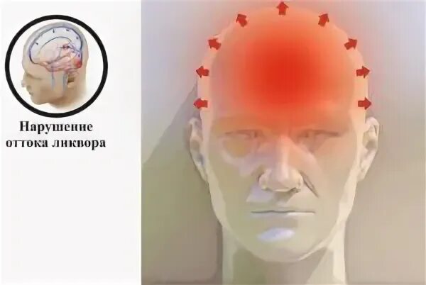 Давит голова и глаза