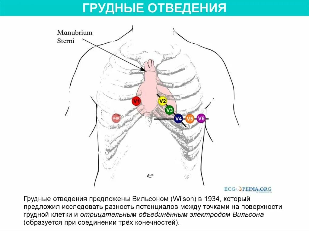 Как установить экг. Экг. схема наложения электродов по вильсону.. грудные отведения на экг электроды. схема наложения электродов по вильсону. однополюсные грудные отведения экг.