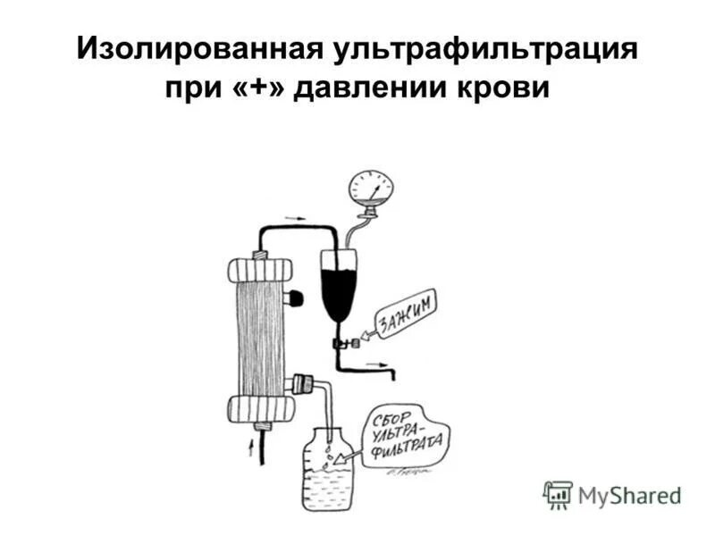 Ультрафильтрация диализ. Изолированная ультрафильтрация. ультрафильтрация крови. ультрафильтрация в медицине.