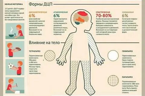 Что такое детский церебральный паралич