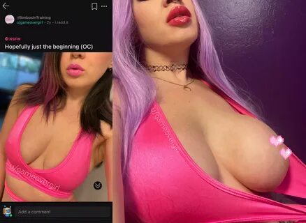 Two years later 💖 injected lips and bolt-on tits (550cc XL expanders) nude...