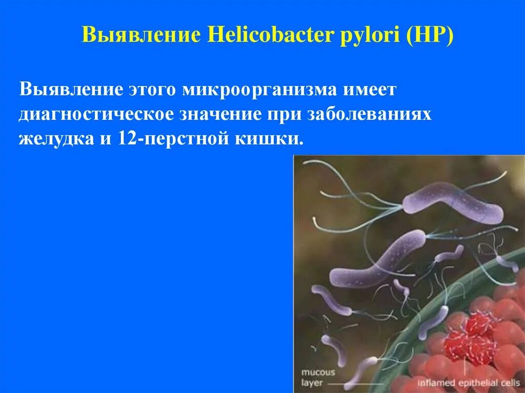 Бактерии хеликобактер причины