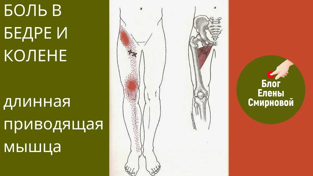 Боль и беда. Болит внутренняя сторона бедра. Болит правая нога и отдает в пах