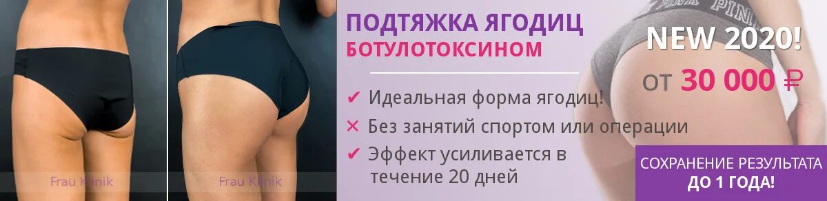 Коррекция формы ягодиц. Подтянуть ягодицы. Ботокс в ягодицы. Безоперационная подтяжка ягодиц.