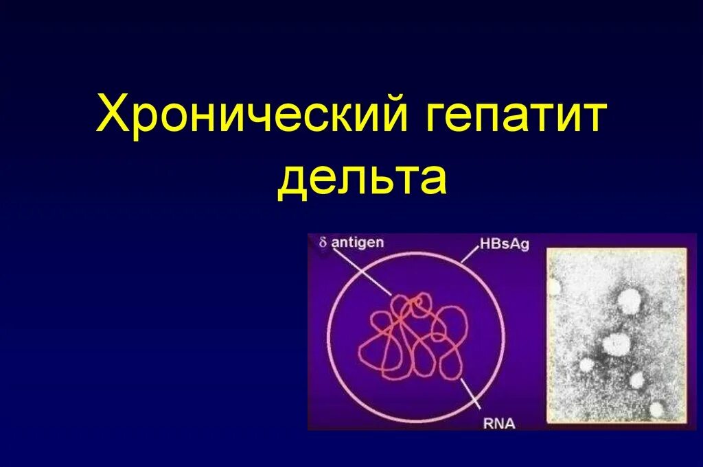 Гепатит в без дельта агента. Вирусный гепатит в без Дельта агента что это такое. Хронический вирусный гепатит в без Дельта-агента. Хронический гепатит в с Дельта агентом. Гепатит б без Дельта агента что это.