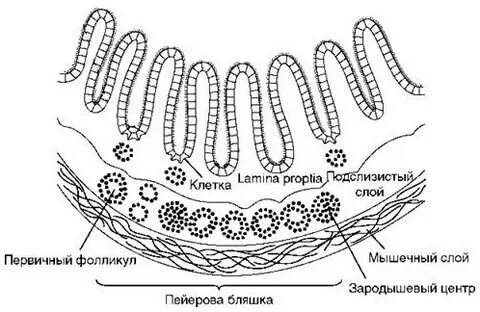 Пейеров бляшки