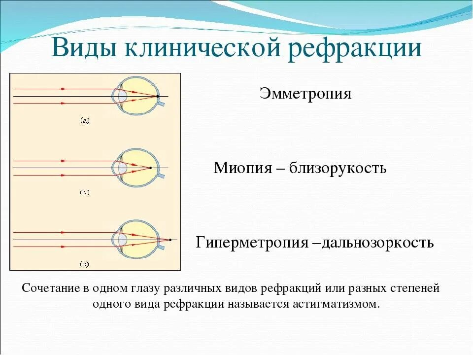 Физ око. Эмметропия рефракция. Физическая рефракция глаза схема. Аномалии рефракции глаза. Типы клинической рефракции глаза.