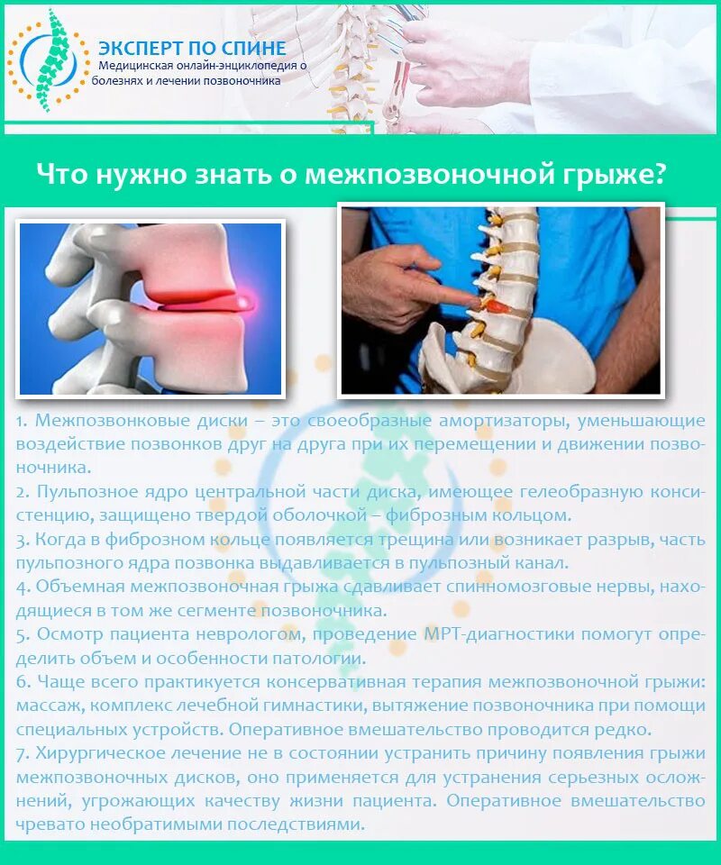 Лечение спины врач. Излечение межпозвоночной грыжи. Грыжа позвоночника поясничного лечение. Терапия при грыже позвоночника.