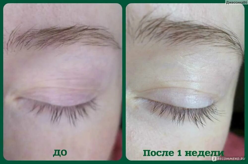 Касторовое масло до и после. Касторовое масло для ресниц до и после. Карепрост +ламинирование ресниц. Касторовое масло для ресниц. Касторка для ресниц до и после.
