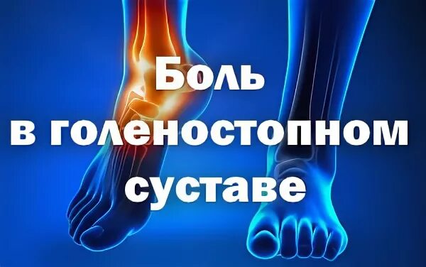 Боли в голеностопном суставе в покое. Болит голеностопный сустав.