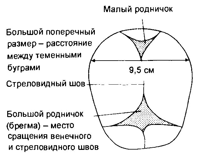 Размеры большого родничка. Измерение размеров большого родничка. Сегменты головки плода. Малый поперечный размер головки плода.