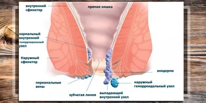 Давление в заднем проходе у женщин