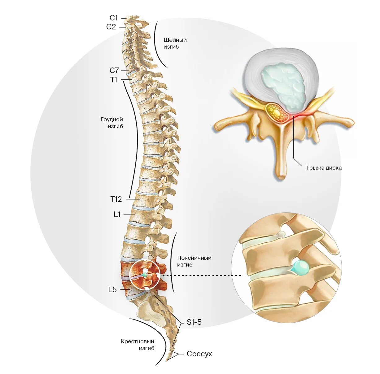 Симптомы поясничного крестцового отдела позвоночника. Позвоночные диски l5-s1. Диски позвонков l3-l4, l4-l5, l5-s1. Диски l1 l2 позвоночные. Позвоночные диски l3-s1.